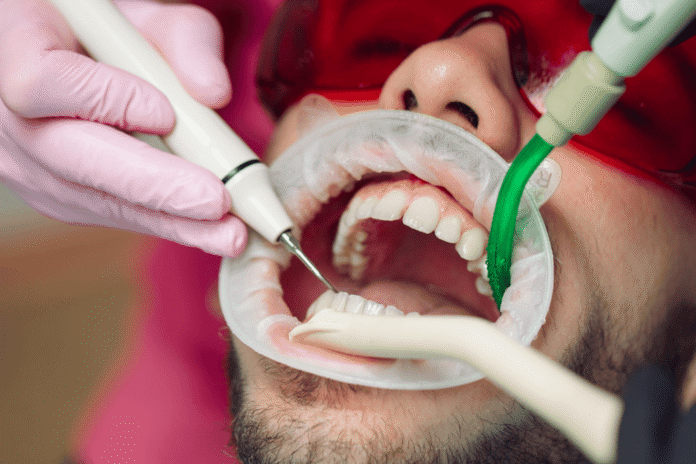 Benefits of Regular Dental Cleaning for Long-Term Oral Health