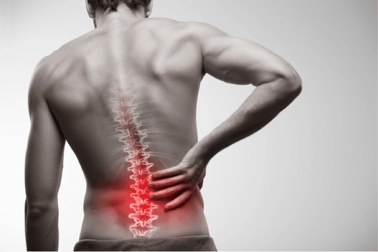 Back Pain and Its Causes