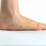 Solutions for Flat Feet