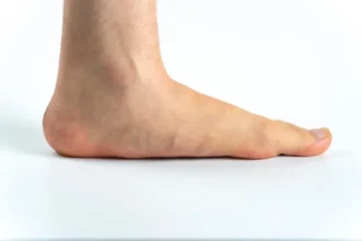 Solutions for Flat Feet