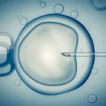 In-vitro Fertilization