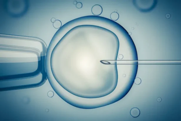 In-vitro Fertilization