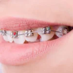 Orthodontics