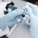 Benefits of STD Screening