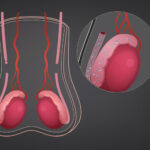 Vasectomy Alternatives