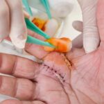 Wound Care Management