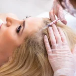 Effective Hair Loss Treatments