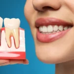 Tooth Replacement Options For Missing Teeth