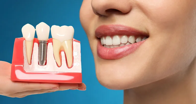 Tooth Replacement Options For Missing Teeth